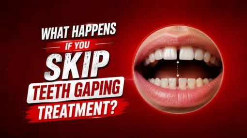 What happens if I skip Teeth Gaping Treatment In Kandivali, Mumbai and let the gap grow?