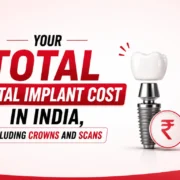 Dental Implant Cost in India