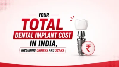 Dental Implant Cost in India