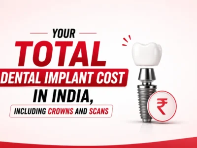 Dental Implant Cost in India