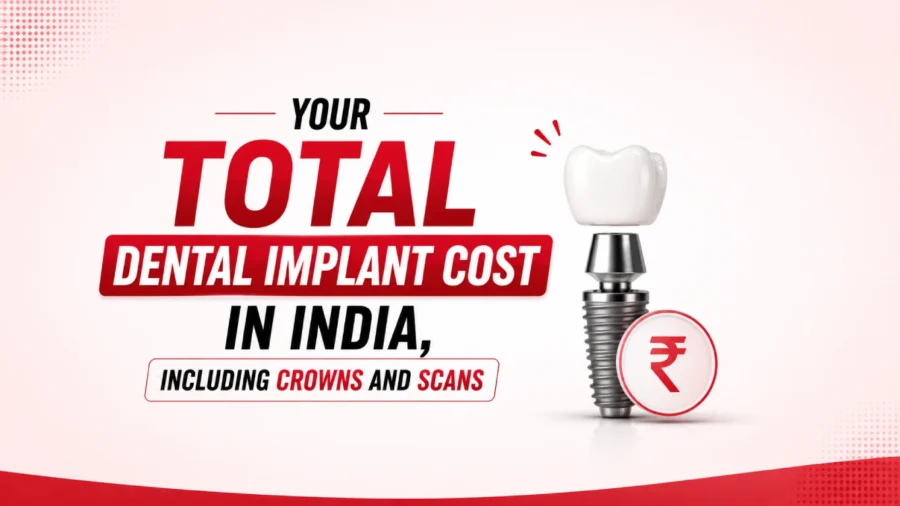 Dental Implant Cost: Are There Low-Cost Dental Implant Options? Royal Dental Clinics Dental Implant Cost in India