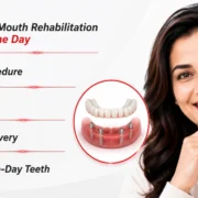 Full Mouth Reconstruction in Kandivali East, Mumbai Royal Dental Clinics Full Mouth Rehabilitation in One Day: Procedure, Cost, Recovery and Same-Day Teeth