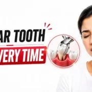 What is the recovery time after Molar Tooth Extraction in Mumbai? Royal Dental Clinics What is the recovery time after molar tooth extraction in Mumbai?