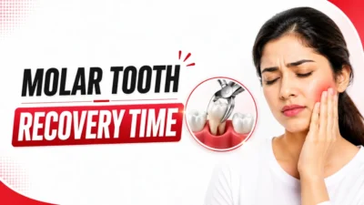 What is the recovery time after Molar Tooth Extraction in Mumbai? Royal Dental Clinics Post Treatment Care What is the recovery time after molar tooth extraction in Mumbai?