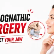 Misaligned Jaw Treatment: Jaw Correction Surgery & Orthognathic Treatment Royal Dental Clinics Orthognathic Surgery in Mumbai, Kandivali