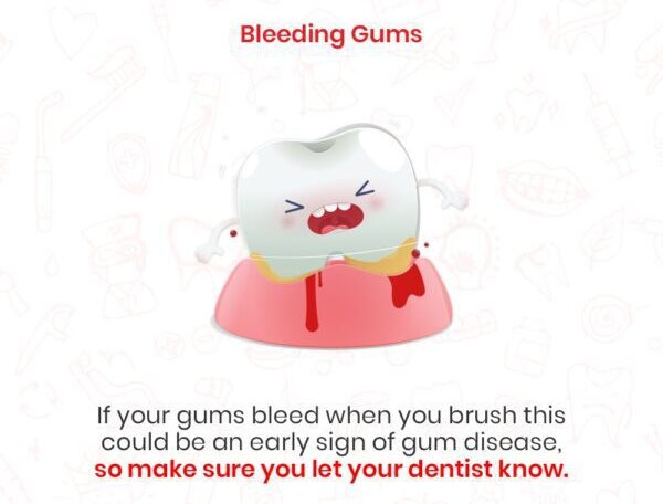Periodontal