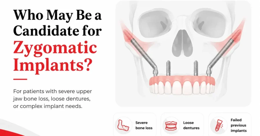 Patient information on Zygomatic Dental Implants