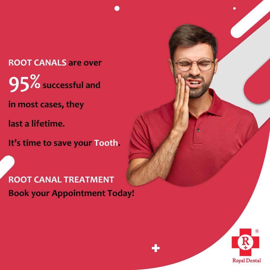 dental pain medicines root canal