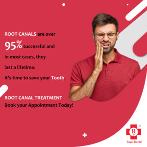 dental pain root canal