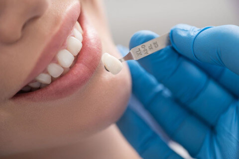 Best way to Close Gaps in Teeth !
