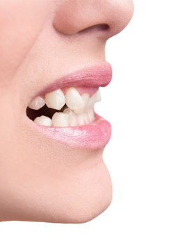 Cosmetic Dentistry Before After | Royal Dental