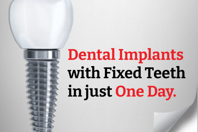 What are the benefits of same day dental implants?