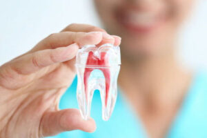 Filing and Root Canal Treatment