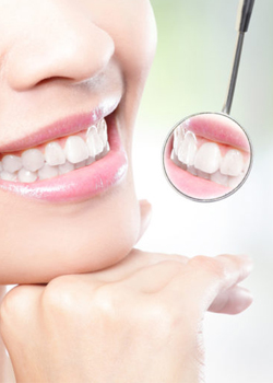 dental veneers cosmetic treatment