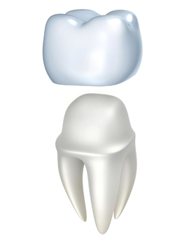 SAPTeeth Dental Crown