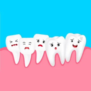 dental crowding teeth correction