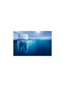 dental iceberg