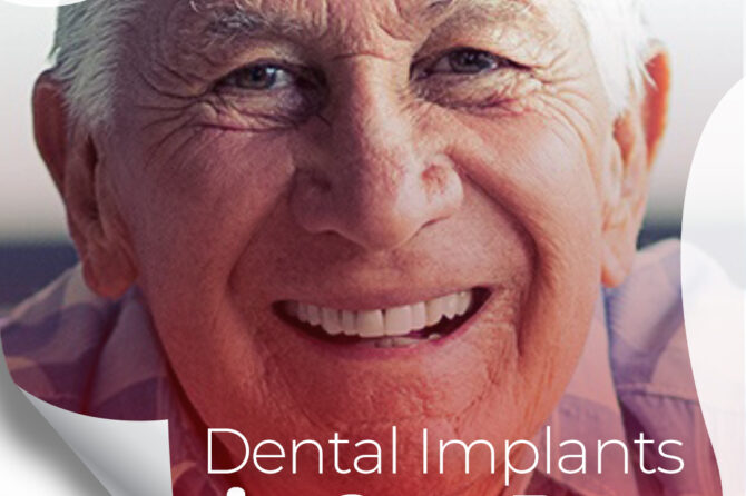 What are the benefits of Dental Implants?
