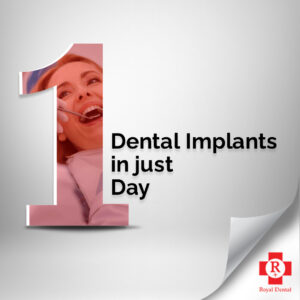 Dental Implants in just 1 Day