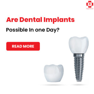 dental implants done in one day