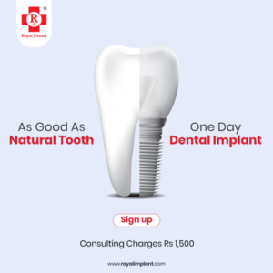 Royal Implant in News | Same Day Dentistry by Digpu