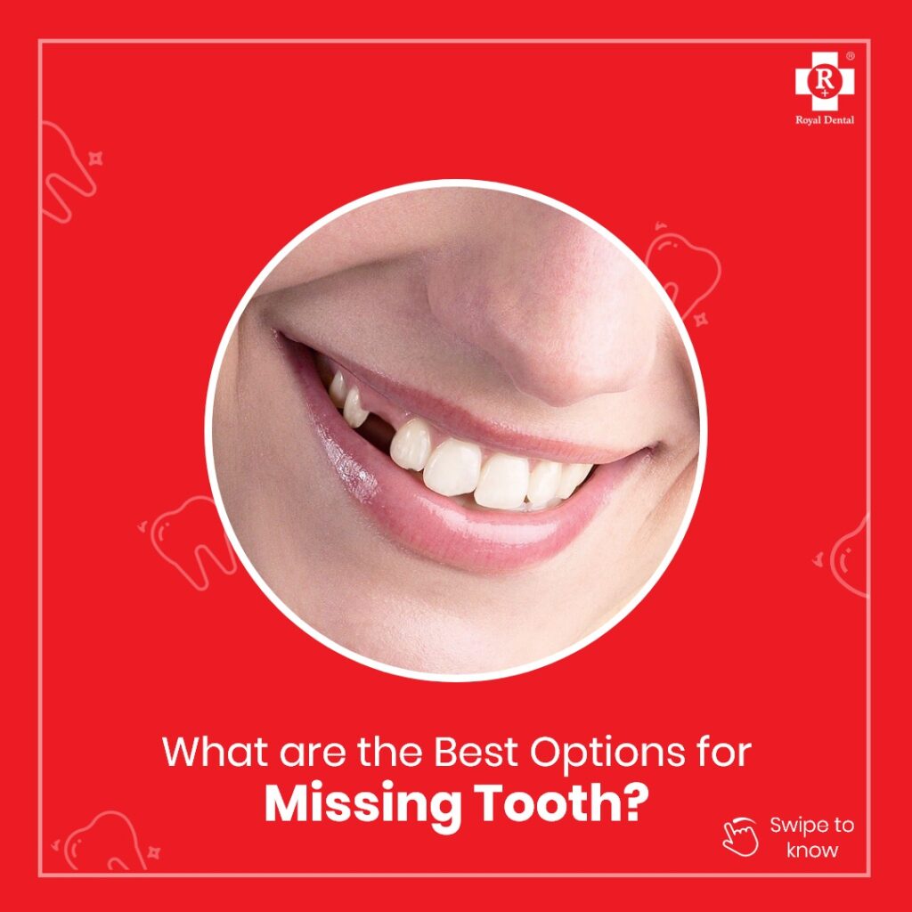 missing tooth? get implants