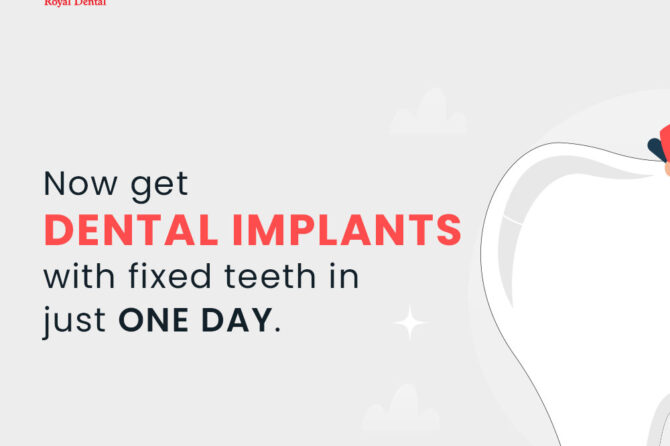 How to care for dental implants?
