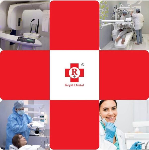 Root Canal Treatment Precaution