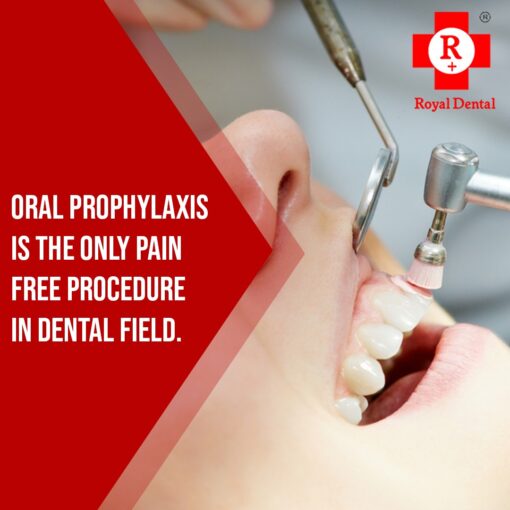 Dental Implant Clinic in Mumbai 3 oral prophylaxis cleaning