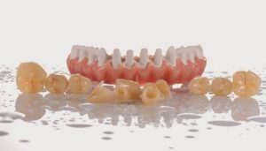 framework with dental crown