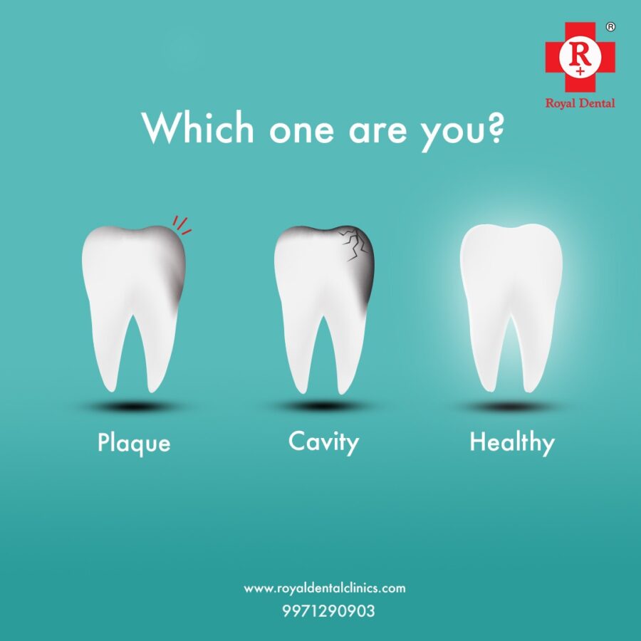 tooth cavity