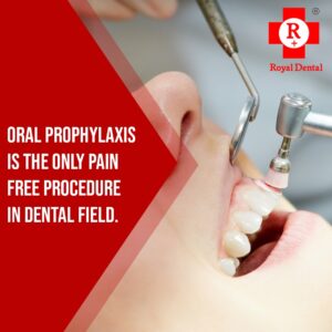 oral prophylaxis cleaning