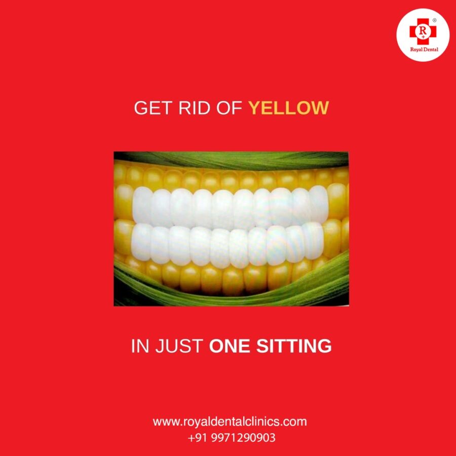 yellow to white