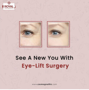 eye lift surgery