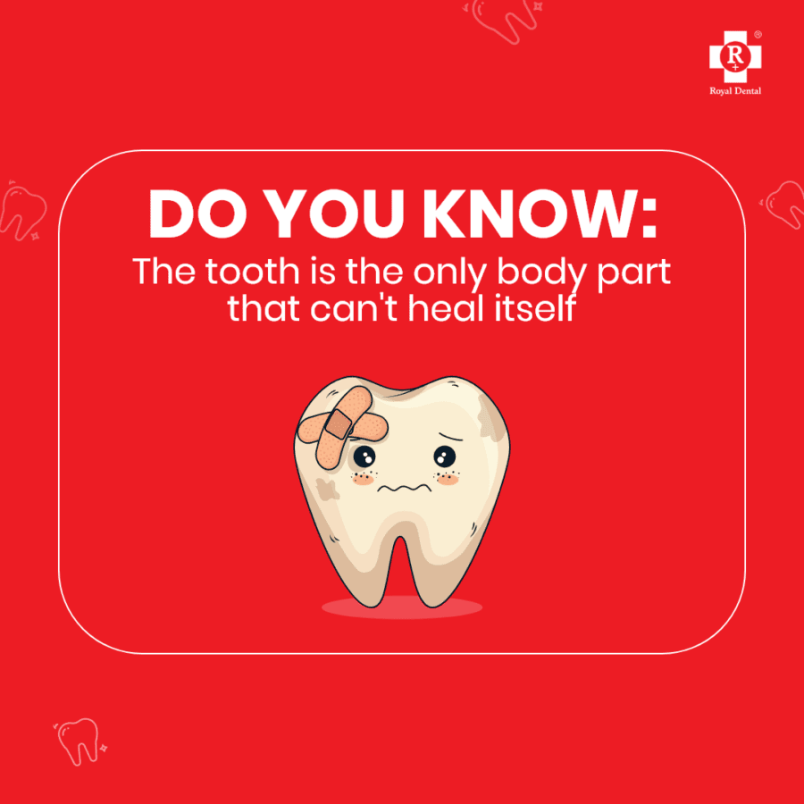 dental caries