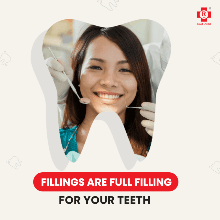 dental fillings
