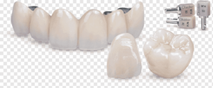 Transparent Tooth Ceramic Crown
