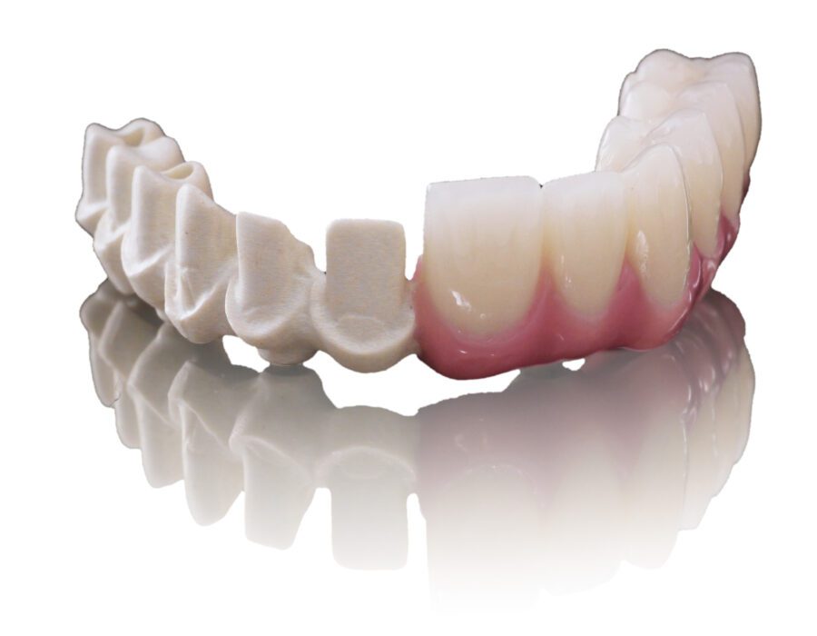 peek in dentistry