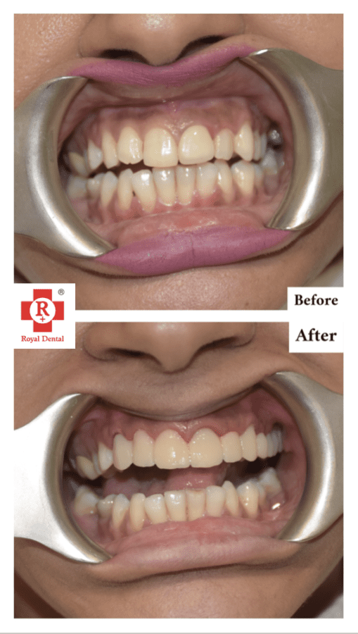 Cosmetic Smile