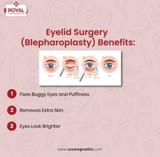 Eyelid Sagging