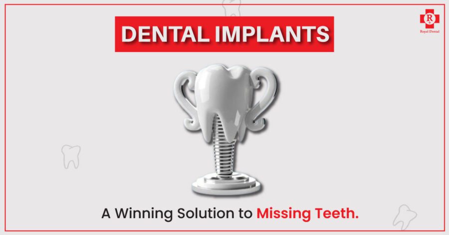 SAPTeeth-implant-surgery