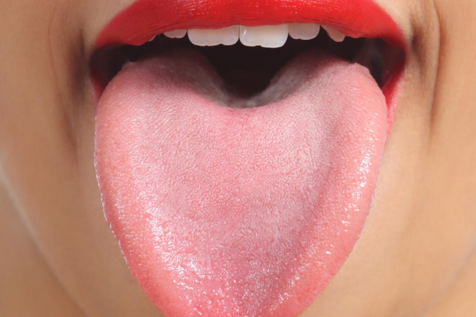 What your Tongue says about your Health