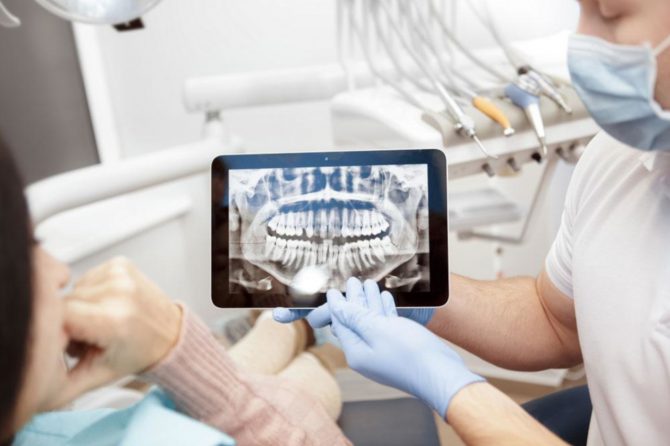 Dental X-Rays | Radiovisiography v/s Orthopantomogram