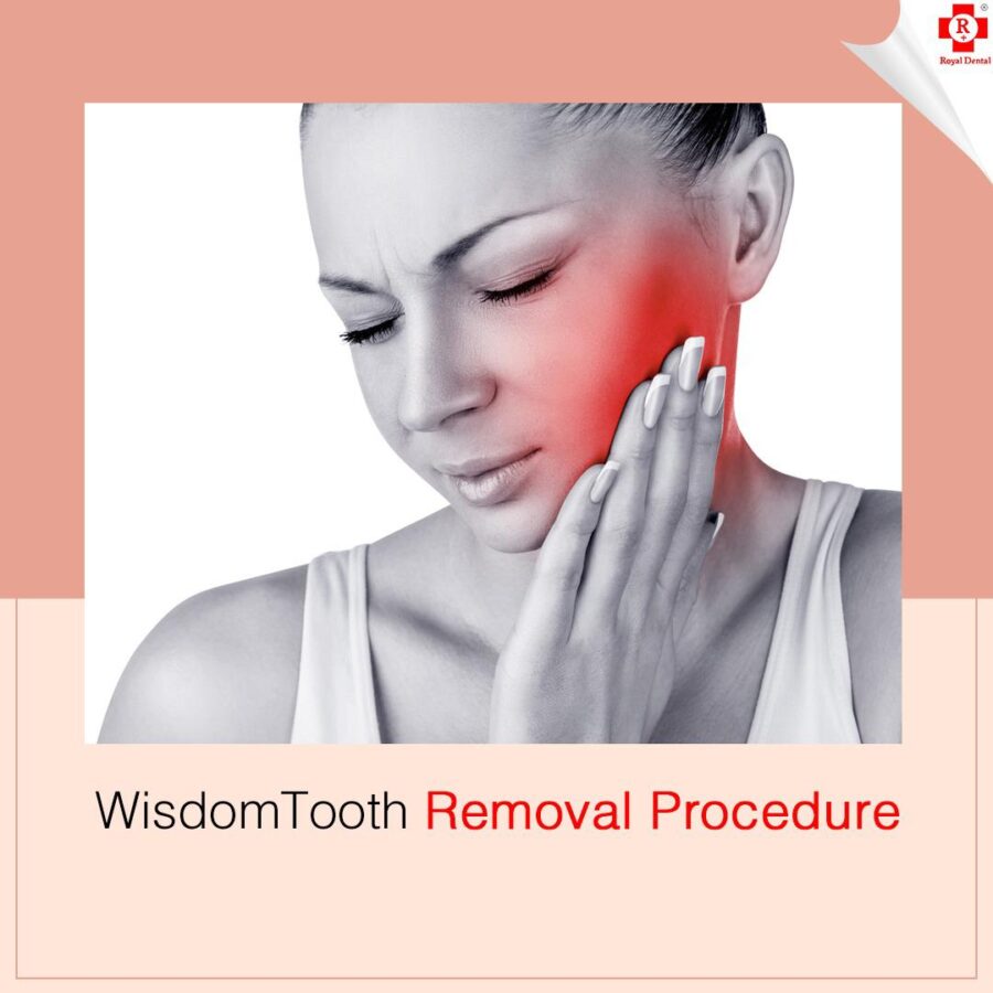 Wisdom Tooth