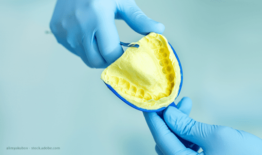 teeth impression