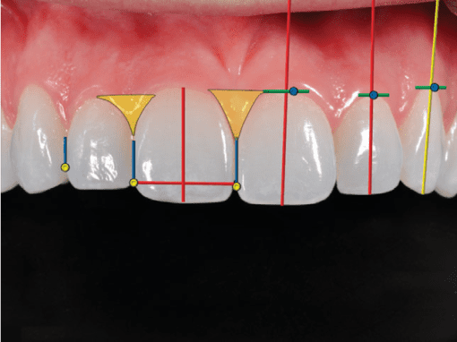 digital smile design
