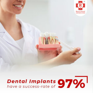 cost of dental implant