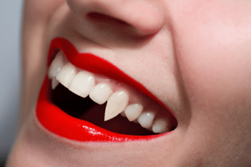 canine tooth cosmetic dentist
