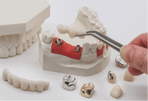 SAPTeeth dental crown