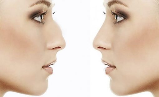 nose reshaping surgery in Mumbai